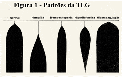 http://www.praticahospitalar.com.br/pratica%2040/img/fig-05-mat-19.gif