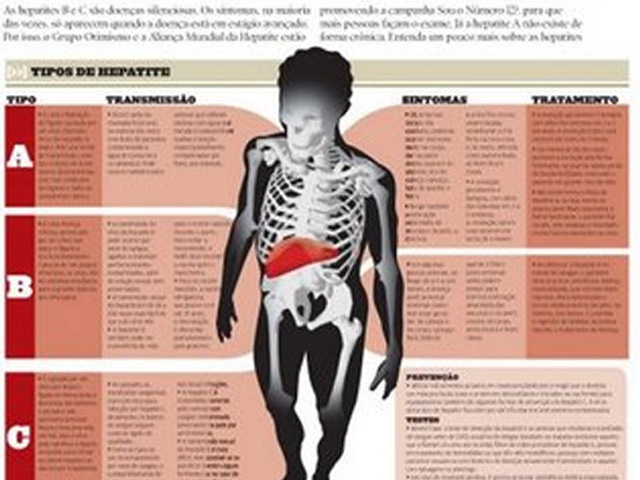 Hepatites